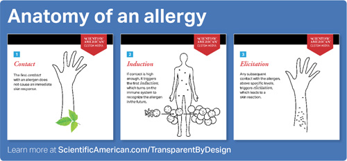 Anatomy of an allergy illustration
