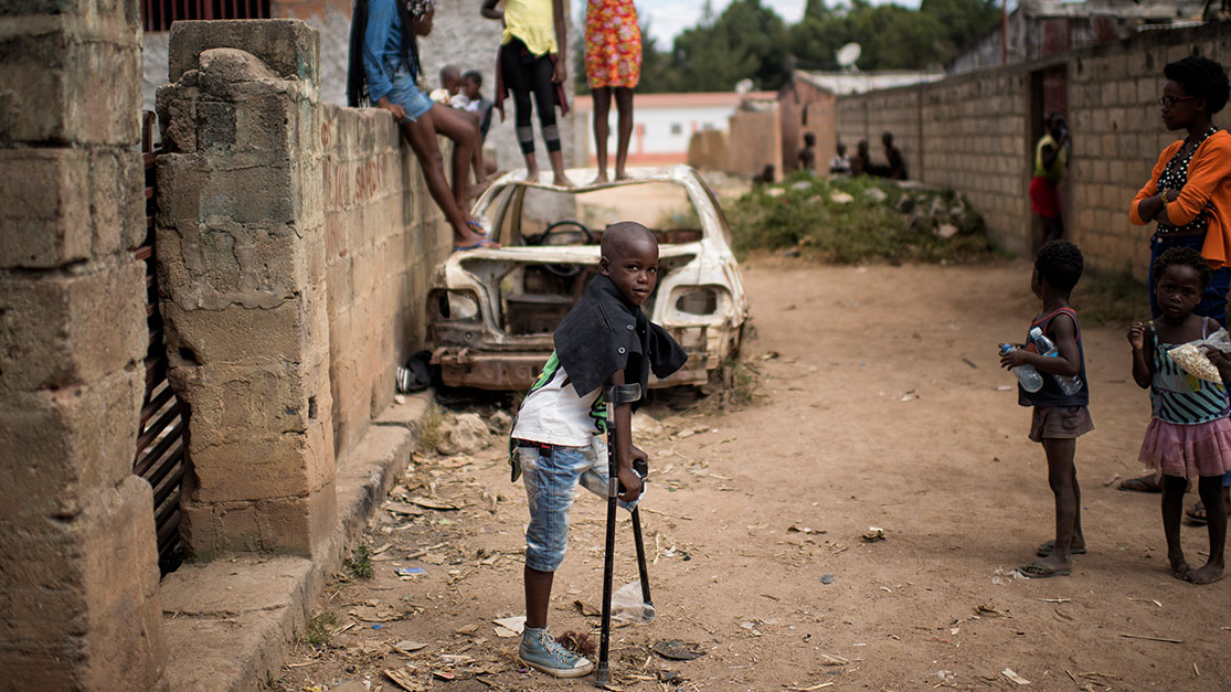 boy with one leg standing in angola